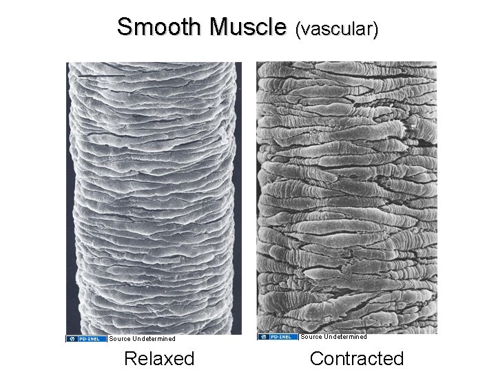 Smooth Muscle (vascular) Source Undetermined Relaxed Source Undetermined Contracted Smooth Muscle (vascular) Source Undetermined Relaxed Source Undetermined Contracted