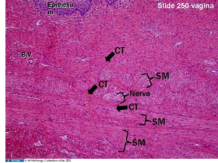 Epitheliu m Slide 250 vagina CT B. V. . CT SM Nerve CT SM