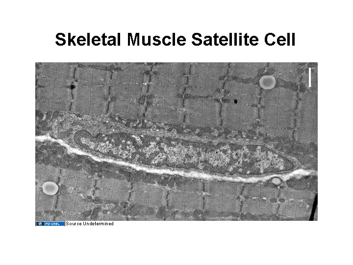 Skeletal Muscle Satellite Cell Source Undetermined 