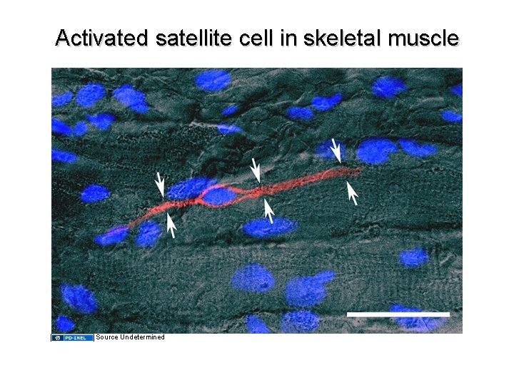 Activated satellite cell in skeletal muscle Source Undetermined Activated satellite cell in skeletal muscle Source Undetermined