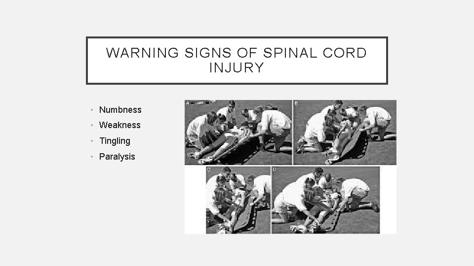 WARNING SIGNS OF SPINAL CORD INJURY • Numbness • Weakness • Tingling • Paralysis