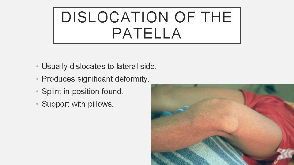DISLOCATION OF THE PATELLA • Usually dislocates to lateral side. • Produces significant deformity.