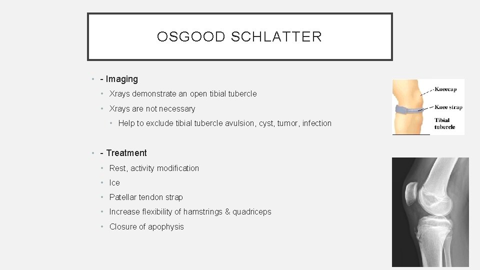 OSGOOD SCHLATTER • - Imaging • Xrays demonstrate an open tibial tubercle • Xrays