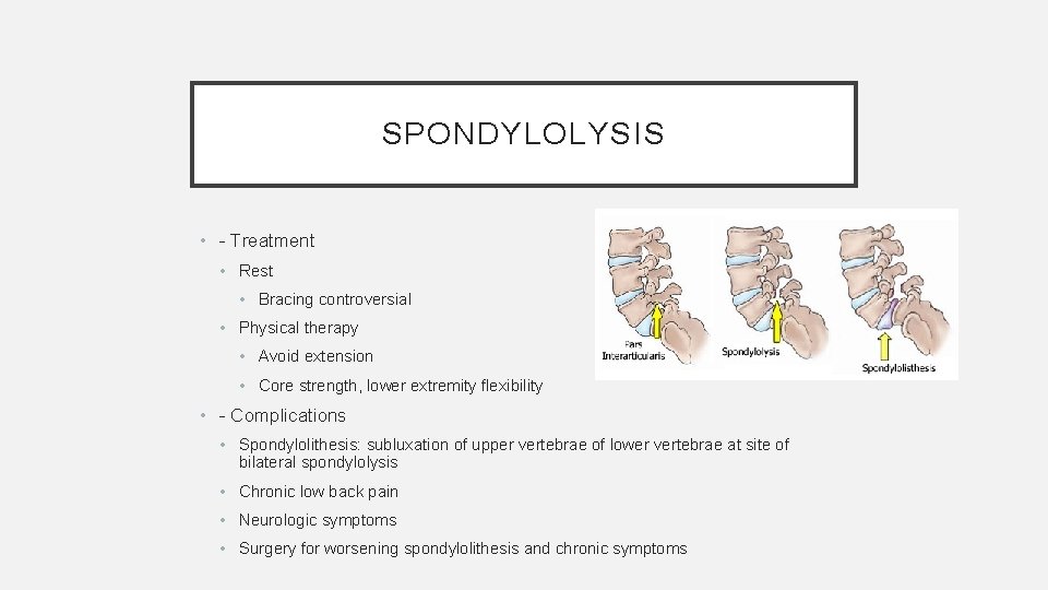 SPONDYLOLYSIS • - Treatment • Rest • Bracing controversial • Physical therapy • Avoid