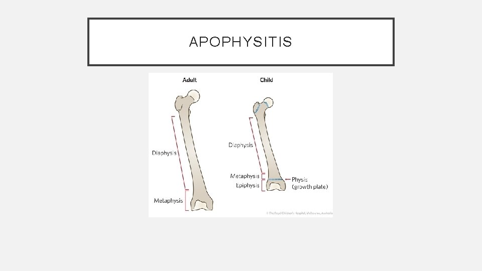 APOPHYSITIS 