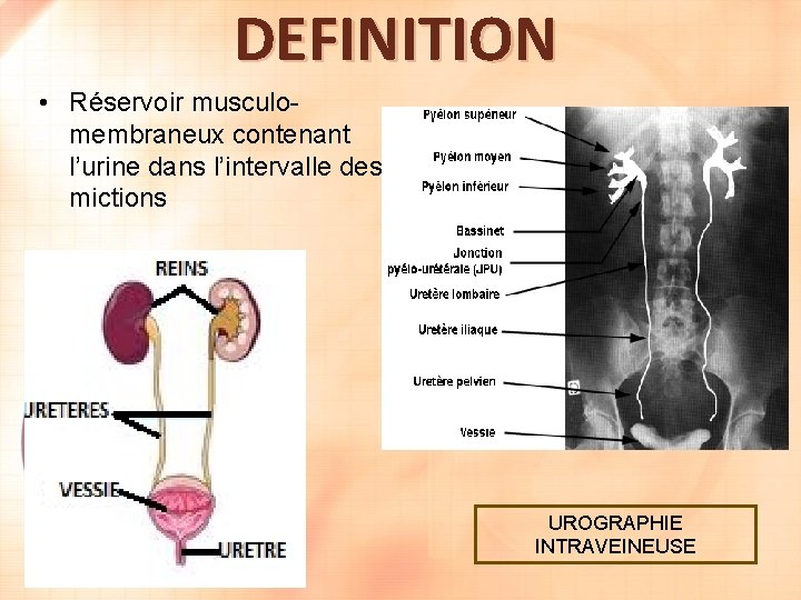 DEFINITION • Réservoir musculomembraneux contenant l’urine dans l’intervalle des mictions UROGRAPHIE INTRAVEINEUSE 