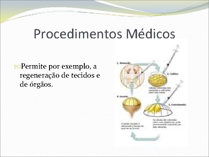 Procedimentos Médicos Permite por exemplo, a regeneração de tecidos e de órgãos. 