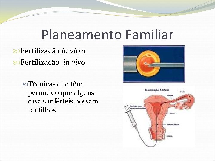 Planeamento Familiar Fertilização in vitro Fertilização in vivo Técnicas que têm permitido que alguns