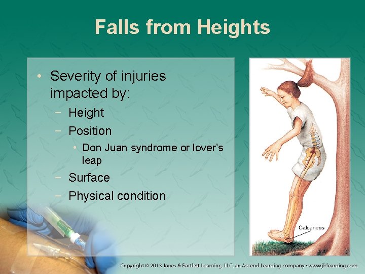 Falls from Heights • Severity of injuries impacted by: − Height − Position •