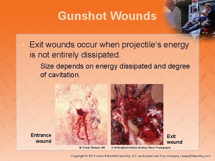Gunshot Wounds • Exit wounds occur when projectile’s energy is not entirely dissipated. −