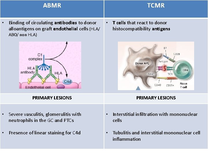 ABMR TCMR • Binding of circulating antibodies to donor • T cells that react