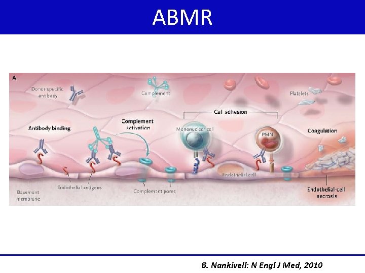 ABMR B. Nankivell: N Engl J Med, 2010 