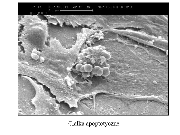 Ciałka apoptotyczne 