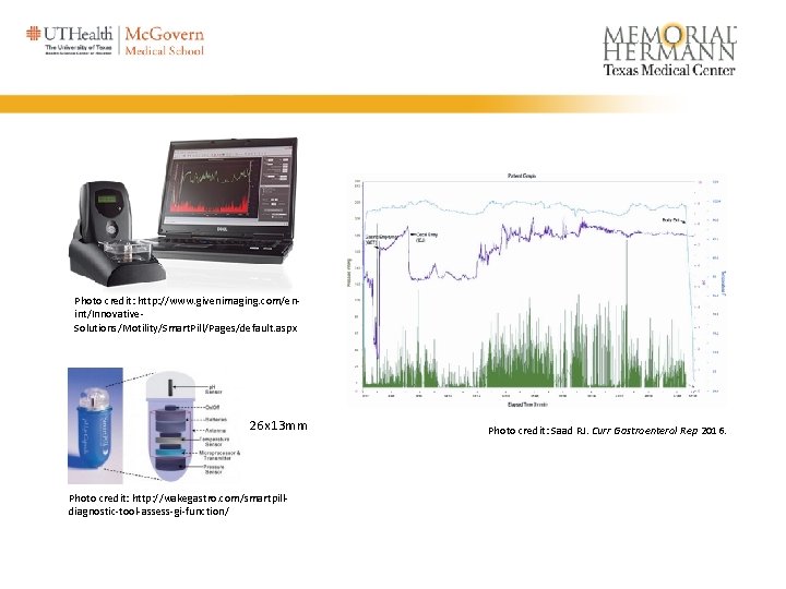 Photo credit: http: //www. givenimaging. com/enint/Innovative. Solutions/Motility/Smart. Pill/Pages/default. aspx 26 x 13 mm Photo Photo credit: http: //www. givenimaging. com/enint/Innovative. Solutions/Motility/Smart. Pill/Pages/default. aspx 26 x 13 mm Photo