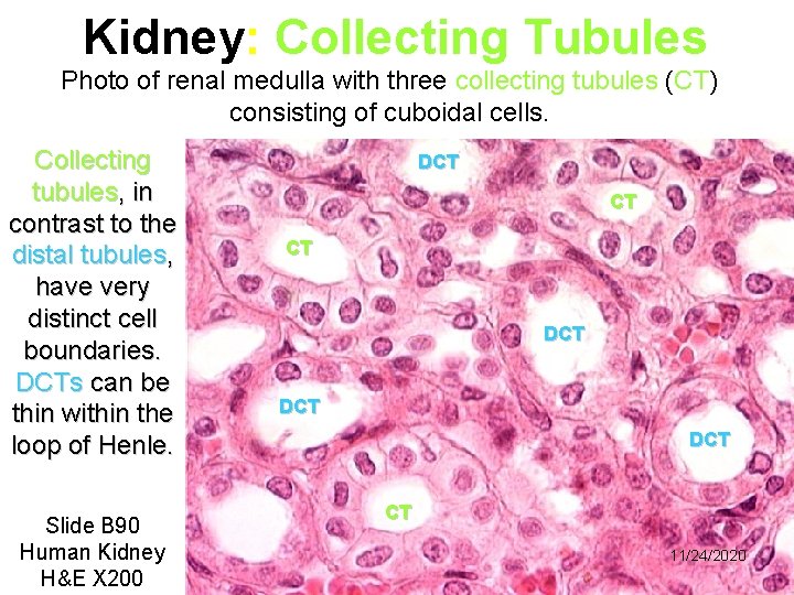 Kidney: Collecting Tubules Photo of renal medulla with three collecting tubules (CT) consisting of