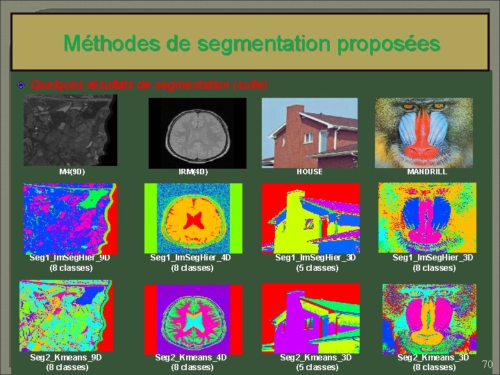 Méthodes de segmentation proposées Quelques résultats de segmentation (suite) M 4(9 D) IRM(4 D)