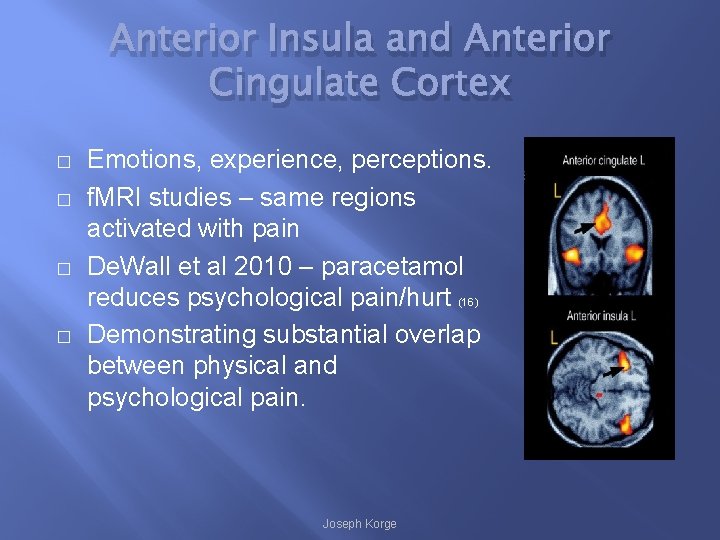 Anterior Insula and Anterior Cingulate Cortex � � Emotions, experience, perceptions. f. MRI studies