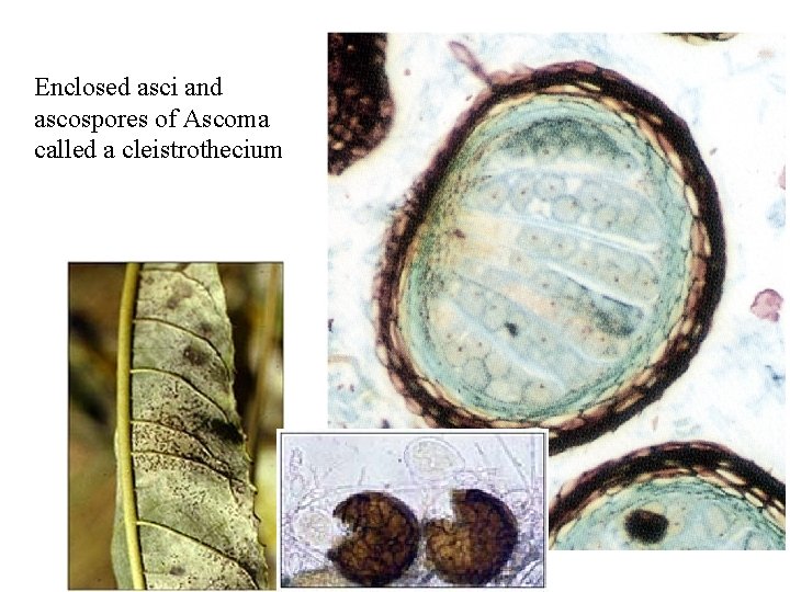 Enclosed asci and ascospores of Ascoma called a cleistrothecium 