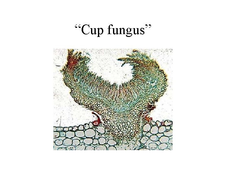 “Cup fungus” 