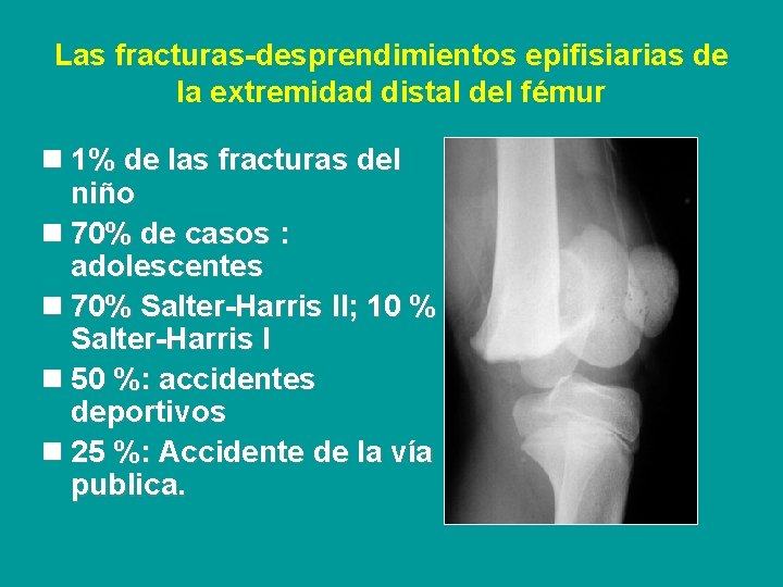 Las fracturas-desprendimientos epifisiarias de la extremidad distal del fémur n 1% de las fracturas