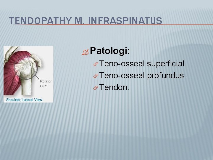 TENDOPATHY M. INFRASPINATUS Patologi: Teno-osseal superficial Teno-osseal profundus. Tendon. 