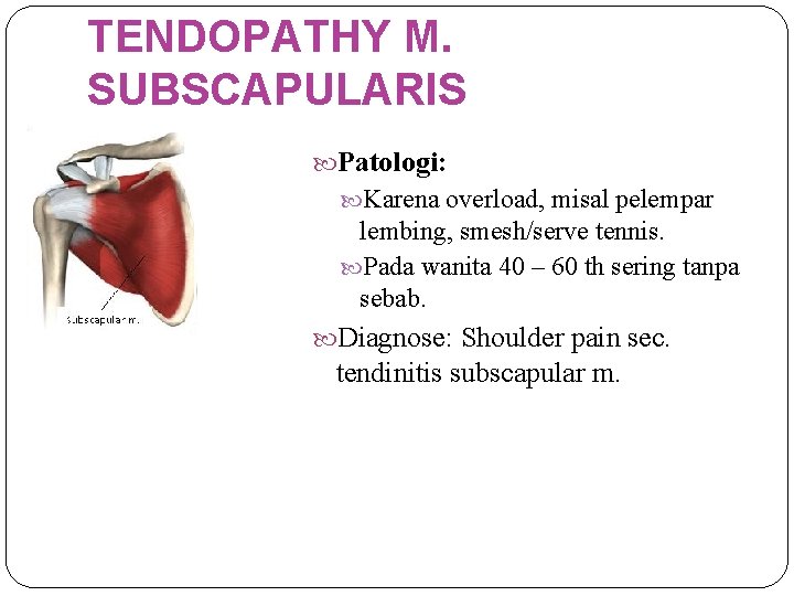 TENDOPATHY M. SUBSCAPULARIS Patologi: Karena overload, misal pelempar lembing, smesh/serve tennis. Pada wanita 40