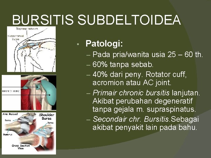 BURSITIS SUBDELTOIDEA • Patologi: – Pada pria/wanita usia 25 – 60 th. – 60%