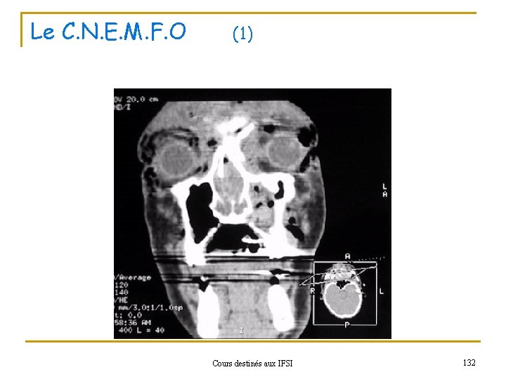 Le C. N. E. M. F. O (1) Cours destinés aux IFSI 132 