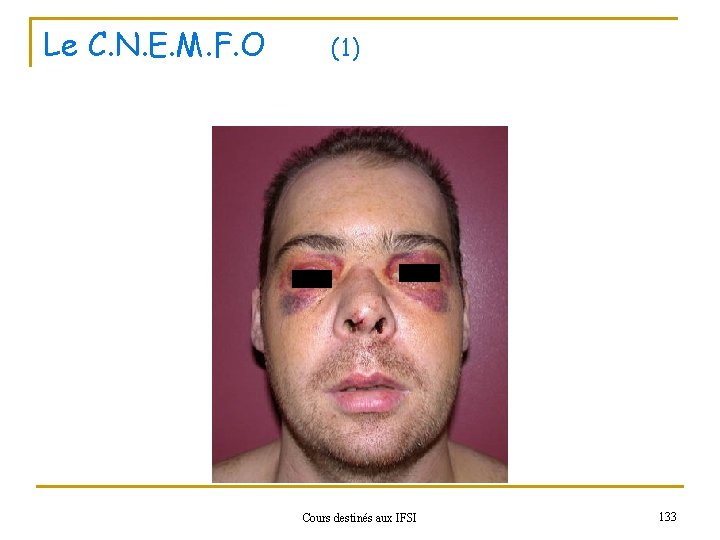 Le C. N. E. M. F. O (1) Cours destinés aux IFSI 133 