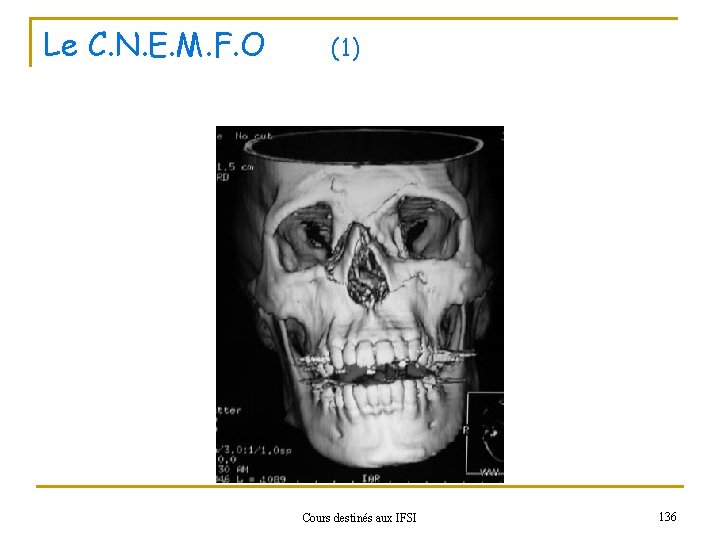 Le C. N. E. M. F. O (1) Cours destinés aux IFSI 136 