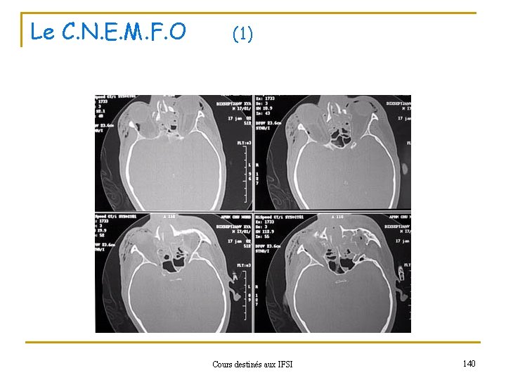 Le C. N. E. M. F. O (1) Cours destinés aux IFSI 140 