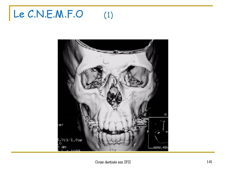 Le C. N. E. M. F. O (1) Cours destinés aux IFSI 141 