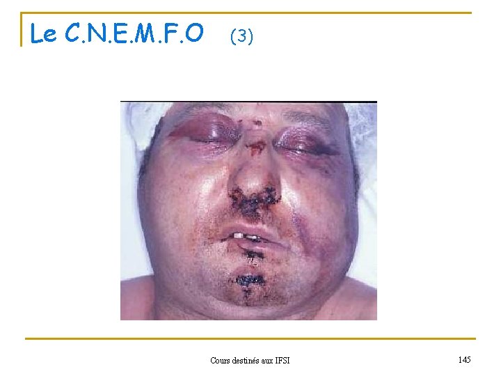 Le C. N. E. M. F. O (3) Cours destinés aux IFSI 145 