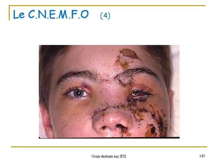 Le C. N. E. M. F. O (4) Cours destinés aux IFSI 147 