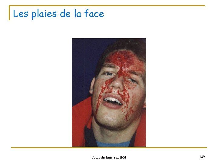 Les plaies de la face Cours destinés aux IFSI 149 