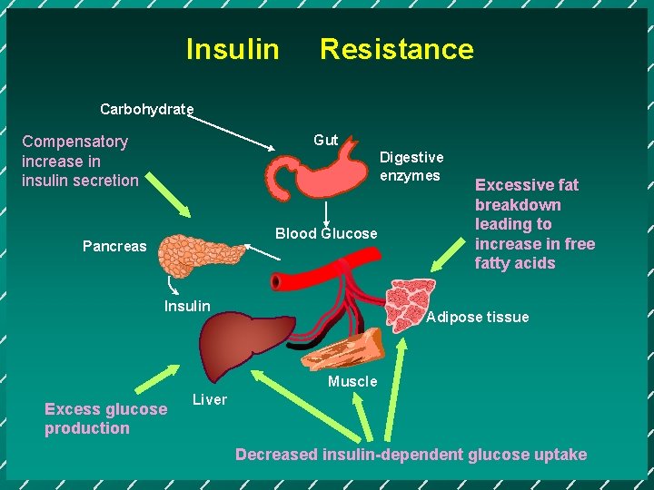 Insulin Resistance Carbohydrate Gut Compensatory increase in insulin secretion Digestive enzymes Blood Glucose Pancreas