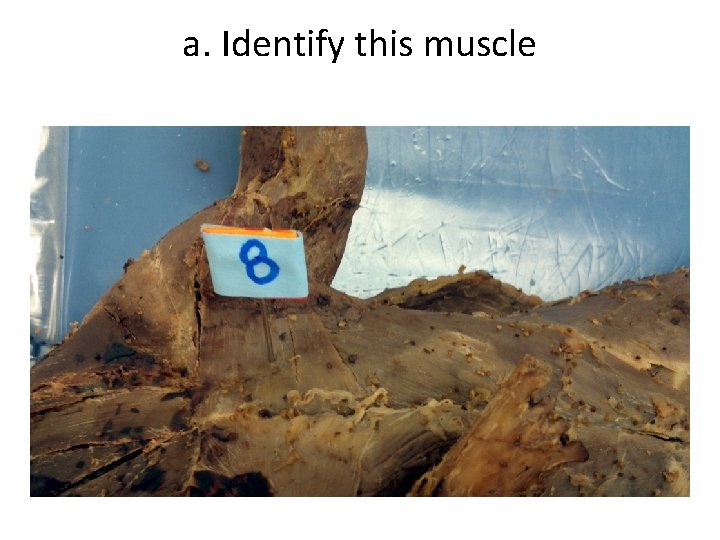 a. Identify this muscle 