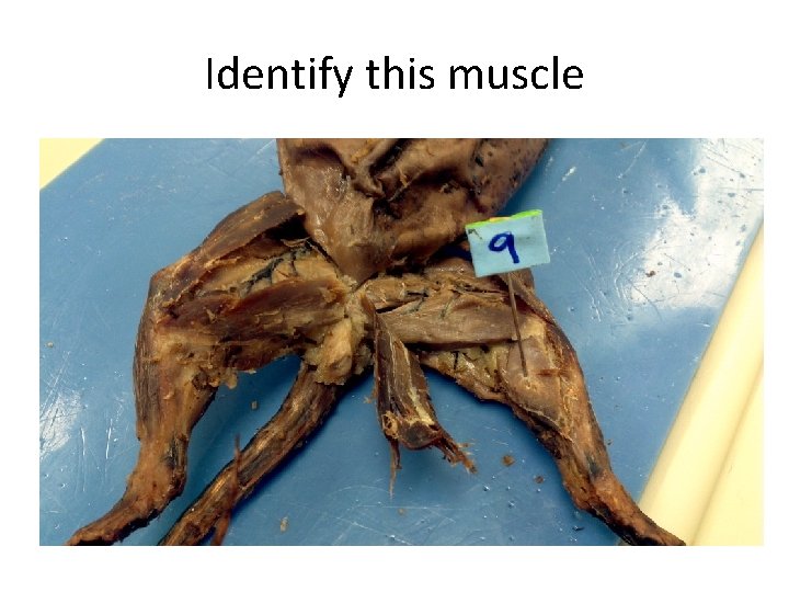 Identify this muscle 