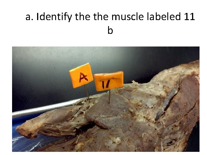 a. Identify the muscle labeled 11 b 