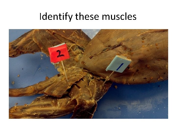 Identify these muscles 