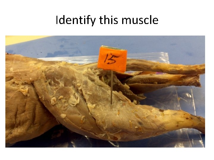 Identify this muscle 