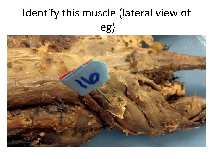 Identify this muscle (lateral view of leg) 