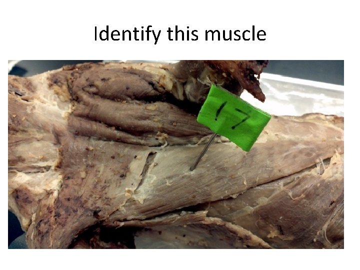 Identify this muscle 