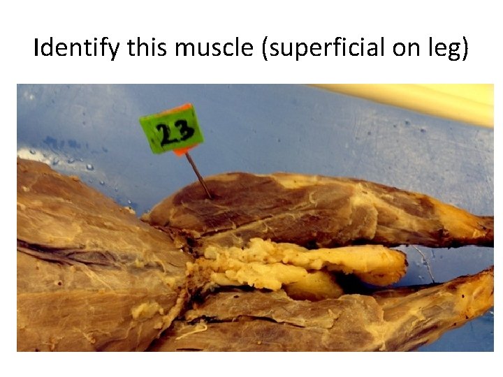 Identify this muscle (superficial on leg) 