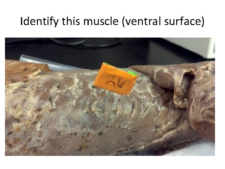 Identify this muscle (ventral surface) 