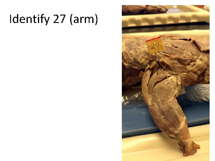 Identify 27 (arm) 