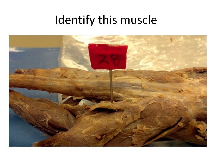 Identify this muscle 