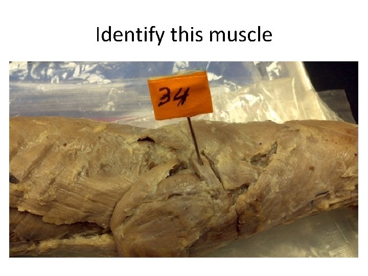 Identify this muscle 