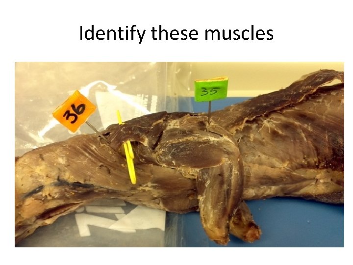 Identify these muscles 