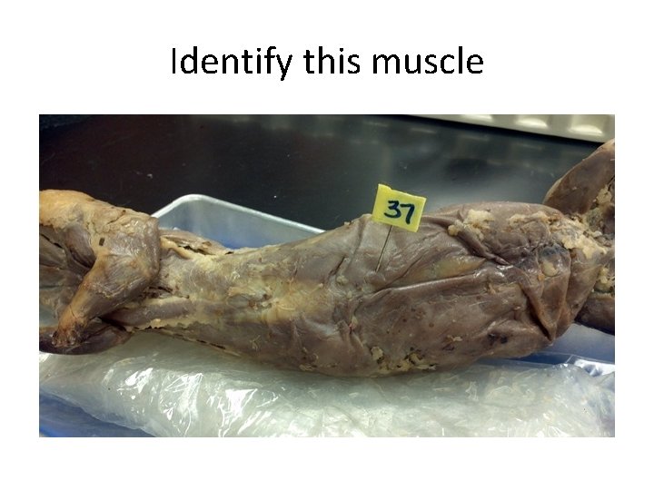 Identify this muscle 